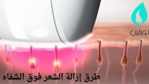 طرق إزالة الشعر فوق الشفاه