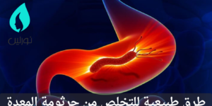 طرق طبيعية للتخلص من جرثومة المعدة