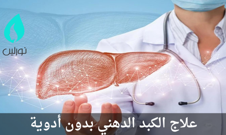 علاج الكبد الدهني بدون أدوية